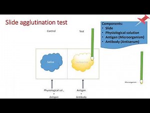 Slide agglutination test