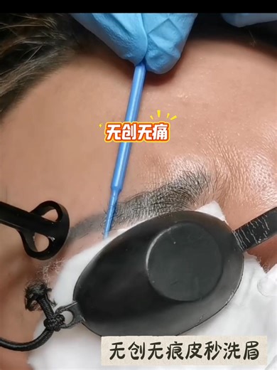 【无创无痕皮秒洗眉】...