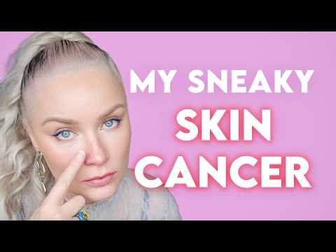 How Doctors Missed the Basal Cell Carcinoma On My Nose