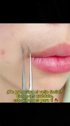 Painless Hair Removal Methods for Sensitive Skin