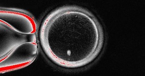 Scientists Made Human Eggs From Skin Cells and Used Them to Form Embryos