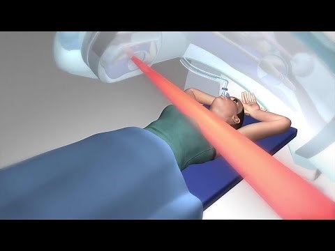 Active Breathing Coordinator (ABC) Device for Breast Cancer