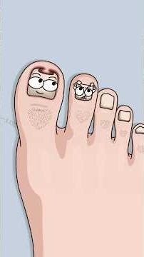 How to avoid a foot infection after a haircut disaster (yes, they’re connected).#shorts