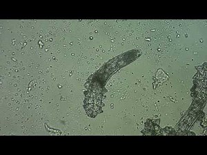 Dermatologia. Demodicosis Facialis. Demodex spp.