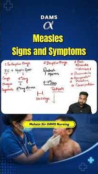 Measles: Signs & Symptoms explained by Mohsin Sir | DAMS Nursing