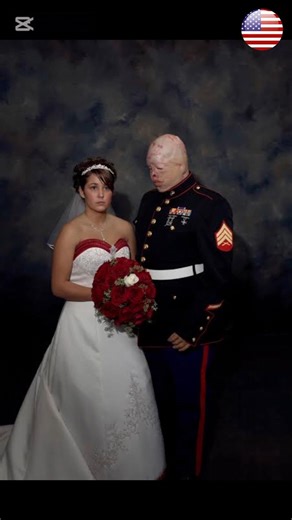 The Hero Who Came Home Changed: The Story of Ty Ziegel 🫡💔 #respect #usarmy #military #shorts #usa