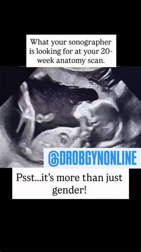 Registered Gynecologist And Obstetrician on Instagram: "DM for online consultation 👩‍⚕️ Visit our hospital in Rawalpindi 🏥 Follow for more informative content Ultrasound Vibes at 24 Weeks Overview Pregnancy Milestone • Baby Development: At 24 weeks, ultrasound imaging shows growing facial features, tiny movements, heartbeat rhythms, and healthy organ formation. High-resolution prenatal scan reveals fetal growth measurements, amniotic fluid levels, placenta position, and baby weight estimation.