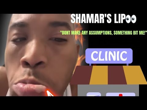 Shamar’s LIP got the INTERNET in a CHOKEHOLD 💀🤣 what REALLY happened?! #viral