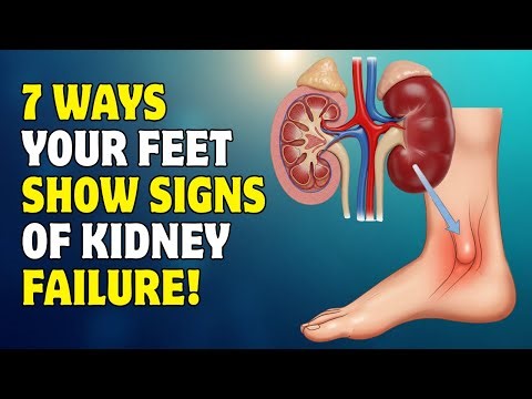 Urologist Explains: 7 Foot Symptoms That Reveal Hidden Kidney Damage (#5 Is Sneaky!)