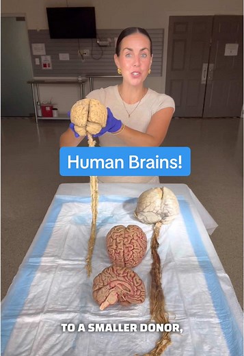 Exploring Real Human Brains: Anatomy Insights