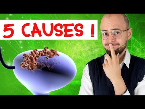 CANCER de la VESSIE : 5 grandes causes !