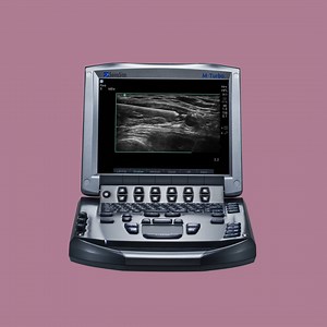 Did you know, when Sonosite M-Turbo launched, it was available in five awesome colors: Pink, Silver, Blue, Green and Orange. Which color would you have picked back then? Comment with your choice, and let’s see which one was the fan favorite. | Fujifilm Sonosite