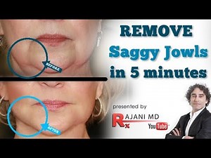 Dissolve & Remove Your Jowls with PDO Threads and Kybella in Portland Oregon
