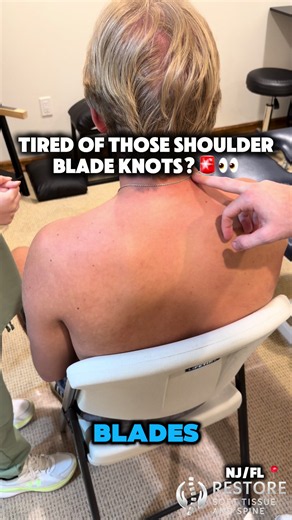Spinal accessory nerve adhesion causing shoulder blade knots