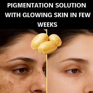 6.7K views · 53 reactions | If you want flawless skin, use it on your face every day. It will remove years of dark spots #beautygirl #Skincare #beautytips | Pure Natural Recipes | Facebook