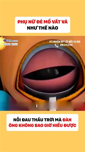 2.3M views · 10K reactions | Sinh con bằng mổ đẻ - Nỗi đau mà đàn ông mãi mãi không thể hiểu được #mebau #mebauthongthai #mangthai #thainhi #babau | Chị Đẹp MANG BẦU | Facebook