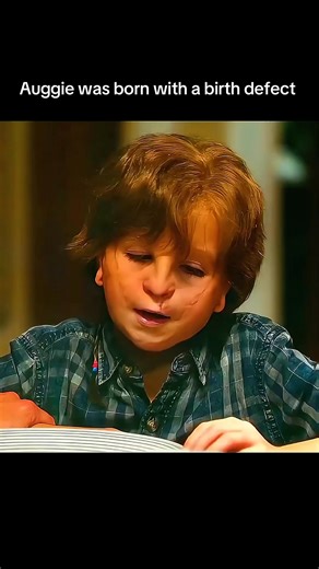 Auggie was born with a birth defect | Movies Recap
