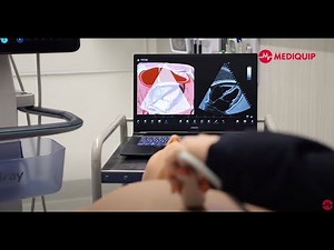 Mediquip Simulation: Elevate Vimedix Ultrasound Simulators