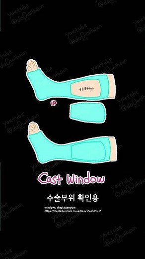 정형외과 보조기 종류 l 신경외과 보조기 종류 l 허리 보조기 l 무릎 보조기