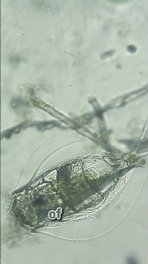 The Tiny Creature With a Spinning Head — The Incredible Belloid Rotifer!