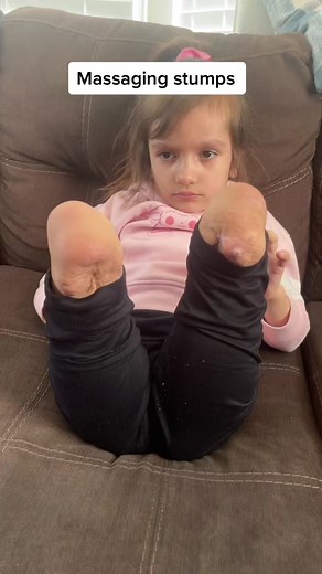 Massaging stumps #fyp #foryoupage #specialneeds #disabilitytiktok #amputeelife #amputeeawareness #massagetherapy