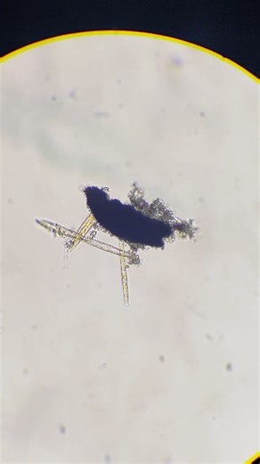 奇異棍形藻的縮時攝影 The time-lapse video of Bacillaria paradoxa