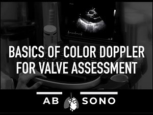 Basics of color Doppler for valve assessment