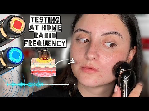 RADIO FREQUENCY for Collagen Production, Skin Tightening & Acne Scars?