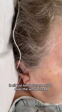 During Vagus Nerve Stimulation | Real-Time Patient Response #acupuncture #vagusnerve #orlando