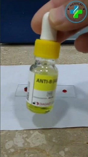 ABO Blood group system | ABO blood typing | blood grouping | know your blood type | Hematology|A-ve