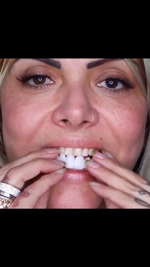 snap on smile on Instagram