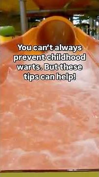 Preventing warts in kids.