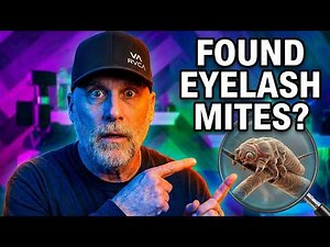 1000x Microscope Exposes the Mites on Your Face Right Now