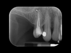 simple reRCT UR4 [re-released]