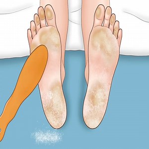 3.5K views · 123 reactions | Asmr So Satisfying! - Homeless Foot Care Animation | Robin's Garden | Facebook