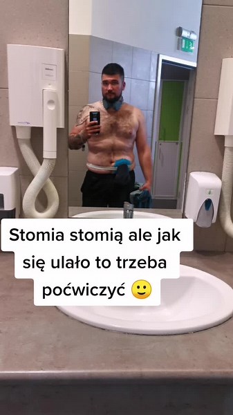 Stomia w niczym nie przeszkadza, a na siłowni nikt nie zwraca uwagi 🙂 #dc #fyp #trening #siłownia #motywacja #dieta #zdrowie #stomia
