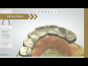 CAD CAM Dental Lab Workflow