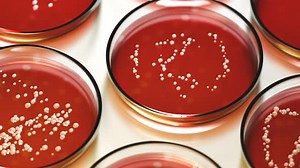 Petri dishes with red blood agar containing colonies of Staphylococcus aureus