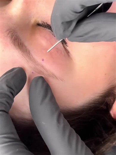 part2 do video q me deu 670 sgdrs / acho lindoo . . . . . . . . #piercing #piercingnasobrancelha #piercings #piercinglovers #trend