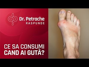 ALIMENTATIA BENEFICA PENTRU GUTA