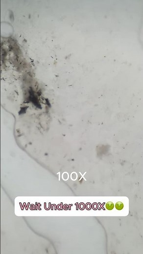 Chicken Gizzard Under the Microscope 🔬 | MicroQuest #microscope #science #microscopicworld