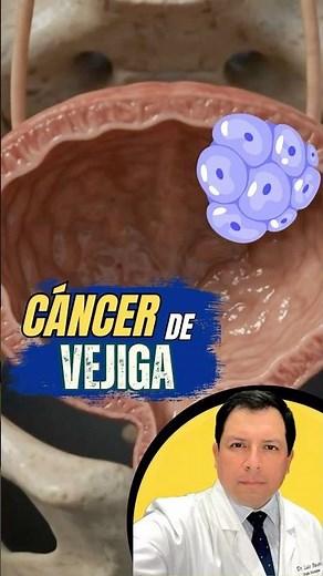 BLOOD IN URINE? BE CAREFUL! #bladdercancer