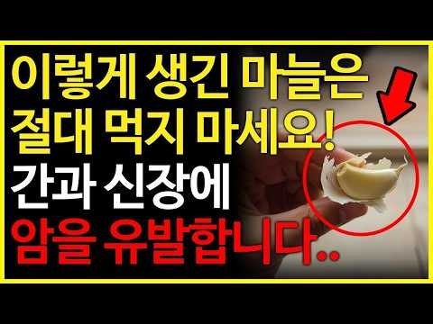 이렇게 생긴 마늘은 절대 먹지 마세요!!! (마늘을 먹으면 안되는 사람, 마늘과 궁합이 좋은 음식들, 마늘 효능!)