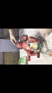 10K views · 135 reactions | Newborn Baby Care _ LBW Baby Oxygen, Cord...