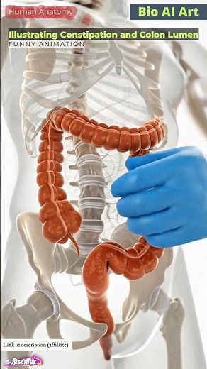 Fecal Impaction Blocks Colon Lumen Animation | Digestive System | Human Anatomy | Bio AI Art | 53