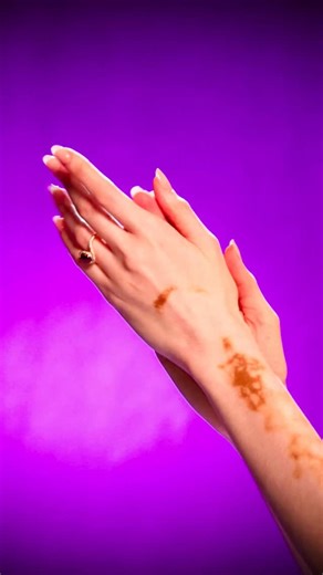 The woman who made us all Wanna Dance with Somebody. The icon, the Voice. Whitney Houston 🎙️ Creative Direction: @winnieharlow Director/Video - @mttalves Photography - @byjamiebruce Makeup - @adamburrell Hair - @viphair_ashanti Production assist - @sabrina_aziz Print design- @fart.pdf Jewelry Design: @laureldewitt Costume Design: @ravissaint @aslihanbal_ | Winnie Harlow