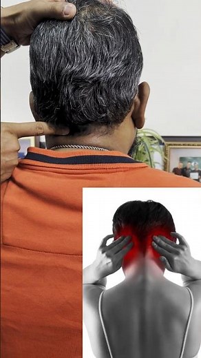 Occipital Neuralgia — Symptoms & Treatment 🧠 #chiropractor