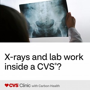 5.4K views · 62 reactions | CVS Clinic with Carbon Health is now open! Get urgent care from our physician-led care team inside your local CVS®. | CVS Pharmacy | Facebook