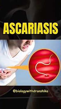 Ascariasis is a common intestinal infection caused by roundworms #pseudoxanthomaelasticum