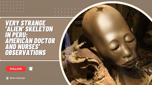Very Strange Alien Skeleton in Peru: American Doctor and Nurses' Observations